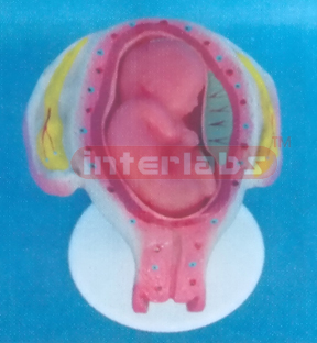 UTERUS WITH EMBRYO (5 MONTH)